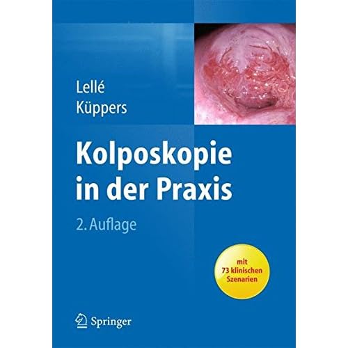 Pdf Kolposkopie In Der Praxis Kostenlos Download Wissenschaftsbuch159