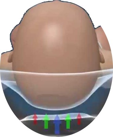 Babykissen für Plagiozephalie | Babykopfkissen gegen Plattkopf | Memory-Schaum-Kissen für Ihr Neugeborenes | Kinderkissen gegen Verformung des Hinterkopfs | Lagerungskissen baby kopf | Kissen für Baby kopfform | 100% GARANTIE und KOSTENLOSE LIEFERUNG - 3