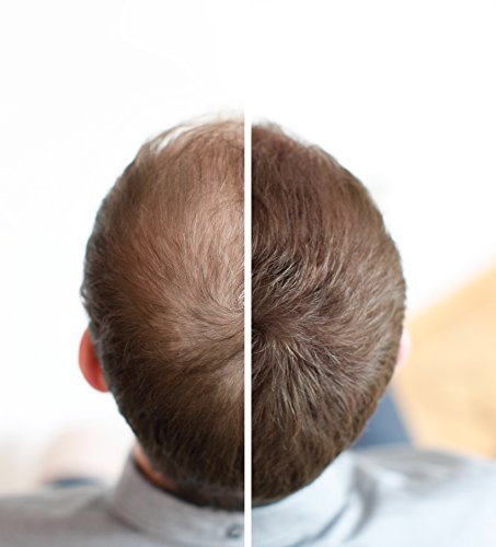 Relight Haarfasern – natürlicher Look dank natürlicher Formel. Volles Haar in Sekunden! (dunkelbraun) Haaverdichtung Schütthaar - 2