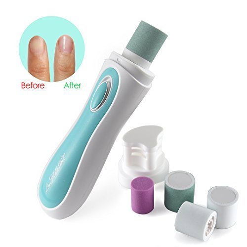 LaFlantine Nagelpflegesystem - elektrisches Maniküre/Pediküre-Tool. Müheloses Feilen und Polieren der Fingernägel und Zehennägel. Lang anhaltende schöne natürlich aussehende Nägel. AA Batterien enthalten. Kostenlose Tasche. Zwei Farben