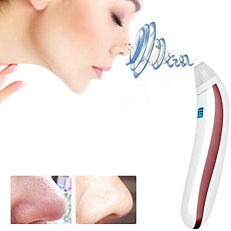 Blackhead Vacuum Electric Cleanser, CHIRISEN Blackhead Removal Pore Cleanser Facial Blackhead Acne Remover Skin Cleaner Vacuum Extraction Tool (White Pink)