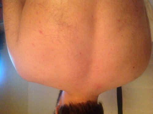 JB repair+care Nachtkerze “ Silber aktiv „… mit dem Silber- / Sauerstoff Komplex, bei Pickeln und Akne, sowie verstopfte Poren - 6