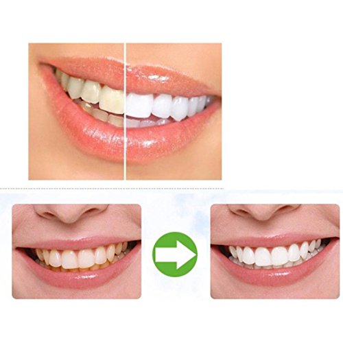 Natürliches Aktivkohle Zahnaufhellung pulver mit Aktivkohle pulver ( activated charcoal teeth whitening ) Mit Ingwerwurzel, Holeider Bentonit-Ton & Calcium NICHT-synthetisch & OHNE Chemikalien - 5