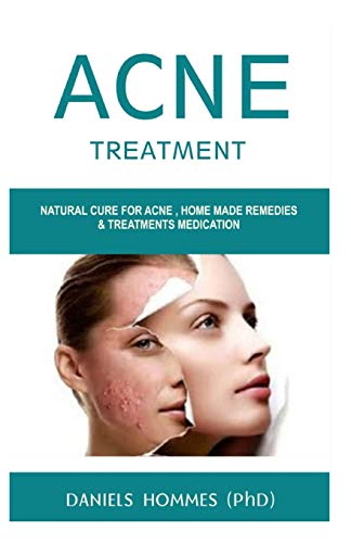 Preisvergleich Produktbild ACNE TREATMENT