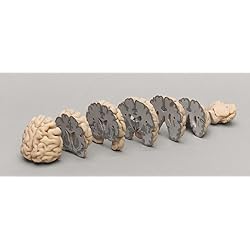 Cerebro humano corte coronal
