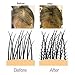 Volumon Professional Hair Building Fibres- Hair Loss Concealer- KERATIN- DARK BROWN 28g- Get Upto 30 Uses
