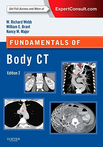 Fundamentals of Body CT, 4e (Fundamentals of Radiology)