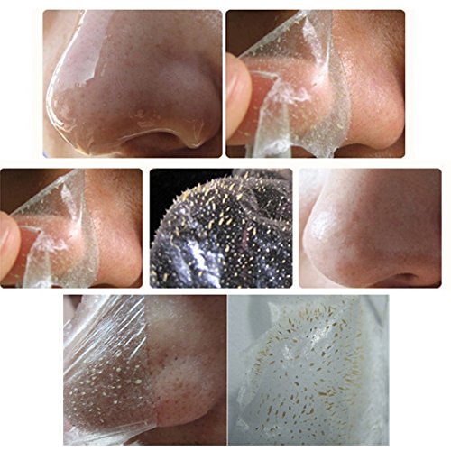 Aloe Vera Gesichtsmaske, LuckyFine zweite Generation black mask / mitesser entferner / schwarze maske / peel off maske / black head killer / gesichtsmaske schwarz / mitesser maske / blackhead maske / blackhead killer maske / blackhead / 100g Aloe Black Head Acne Killer Aloe-Saft Mitesser Kristall Crystal-Maske - 6