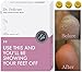 BEST RATED Baby Foot Peel Pedicure Mask by Grace & Stella® - Odor Eliminator & Callus Remover - 100% Satisfaction Guarantee - Do It Yourself At Home Moisturizing Cuticle Soaks Socks (UK Seller) (1 Pair (£9.95/pc), Lavender)