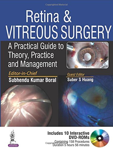 Retina & Vitreous Surgery: A Practical Guide to Theory, Practice and Management by Subhendu Kumar Boral (2016-06-30)