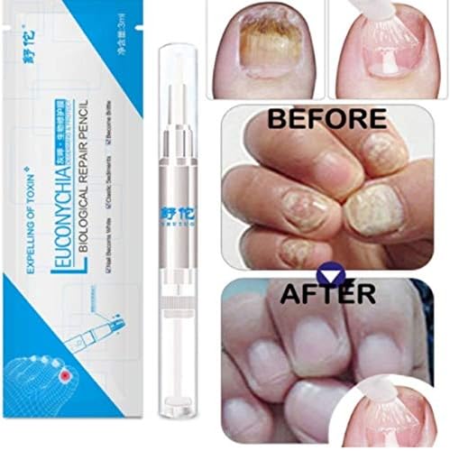 LasVogos 3ML Fungal Nail Treatment Pen Onychomycosis Paronychia Anti Fungal Nail Infection Chinese Herbal Toe Nail Fungus Treatment