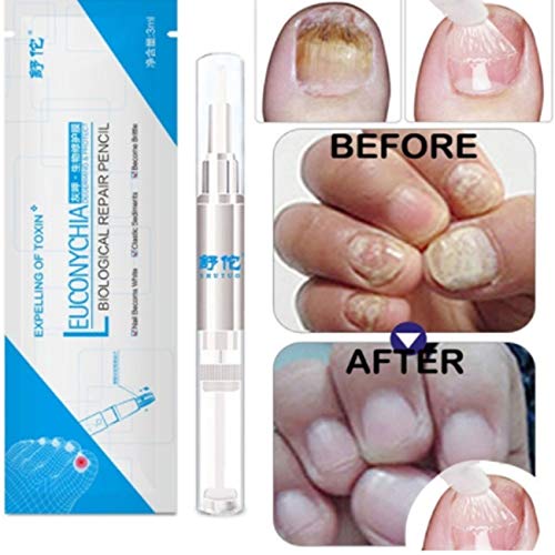 LasVogos 3ML Fungal Nail Treatment Pen Onychomycosis Paronychia Anti Fungal Nail Infection Chinese Herbal Toe Nail Fungus Treatment
