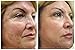 FANTASTIC SKIN BRIGHTENING WHITENING BAR COVER BLEMISHES SPOTS SCARS FRECKLES UNEVEN SKIN TONE