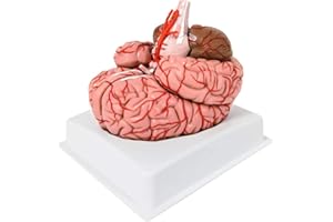 EVOTECH SCIENTIFIC Human Brain w/Arteries, 9 Part Brain with Arteries Model, Human Brain Anatomy for Science Classroom Study Display Teaching Medical Model