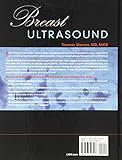 Image de Breast Ultrasound