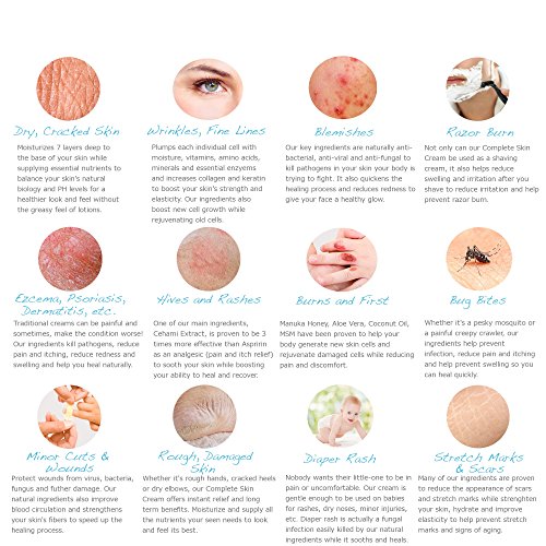 Natürliche Feuchtigkeitscreme 120ml Verbesserte Heilung dank 10-zu-1 fettfreier Formel mit Bio-Aloe Vera, Manuka-Honig, Kokosnussöl und mehr. Die beste Creme für fettige, trockene, strapazierte und sensible Haut - 4