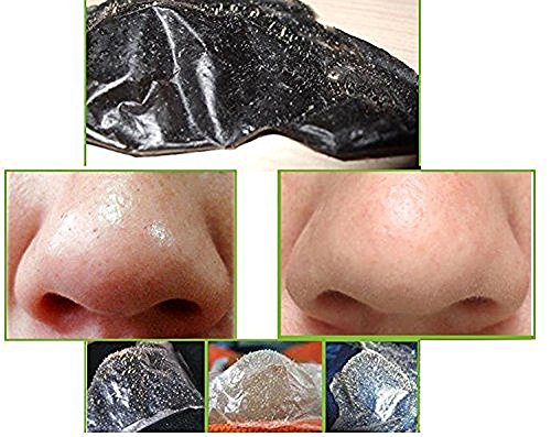 6 x Black Head Peel Off Mitesser Maske Sparset - 4