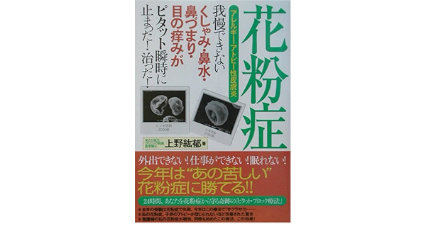 花粉症 アレルギー アトピー性皮膚炎 我慢できないくしゃみ 鼻水 鼻づまり 目の痒みがピタット瞬時に止まった 治った Amazon De Bucher