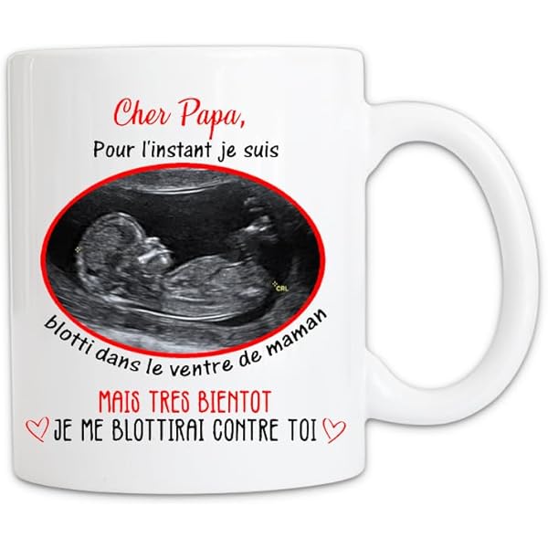 Vis à Pouce (vis Papillon) En Acier Inoxydable A2 304 - Tailles M5 Et M6 - Pour Fixation Rapide Sans Outil