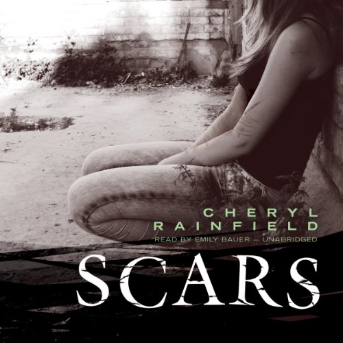 Scars Scars