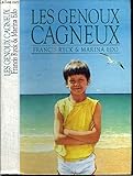 Les genoux cagneux