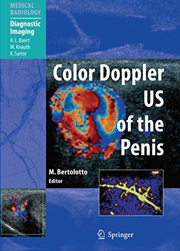 Color Doppler Us of the Penis