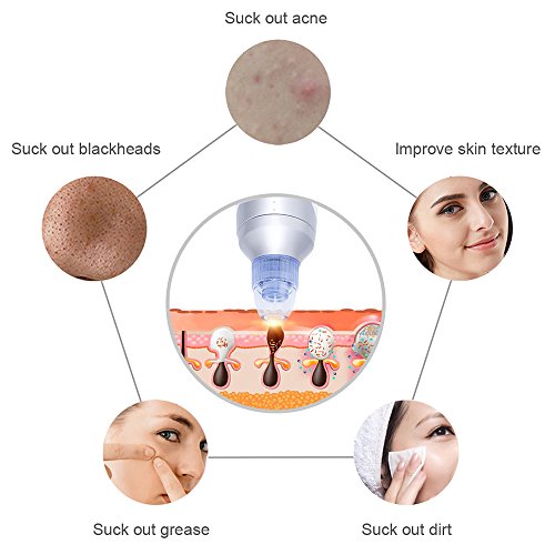Beautystar Diamond Dermabrasion Microdermabrasion, Portable Vacuum Skin Peeling Machine Blackhead Suction Extraction Machine Removal for Facial Rejuvenation with USB Adapter - 4