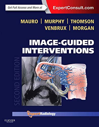 Image-Guided Interventions: Expert Radiology Series (Expert Consult - Online and Print), 2e