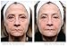 My Perfect Facial 5 Treatment Kit