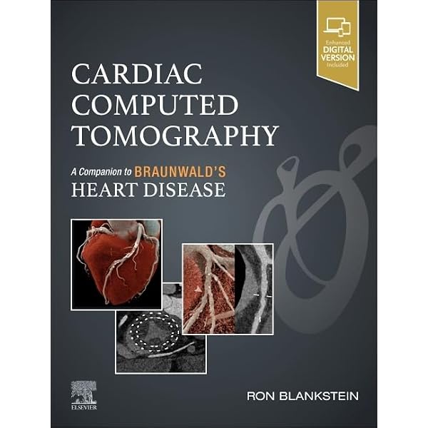 Buy Chou's Electrocardiography in Clinical Practice: Adult and