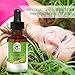 SheaLite Hyaluronic Acid Serum And Vitamin C - Reduces Wrinkles, Age Spots And Acne - For All Skin Types Including Those With Sensitive Skin - Natural And Organic Ingredients - 30ml