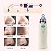 [2018 UPGRADED] The Original Comedo Suction Microdermabrasion Machine Blackhead Removal Rechargeable Skin Peeling Machine By Krasr Comedone Extractor Set - Exclusive