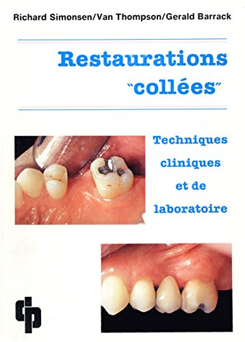 Download Restaurations collées: Techniques cliniques et de laboratoire Download Restaurations collées: Techniques cliniques et de laboratoire