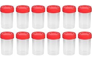 UEETEK Vaso para muestras, 20 piezas Práctico envase de orina de plástico de 60 ml EO estéril sin etiqueta para uso médico de laboratorio (color aleatorio)