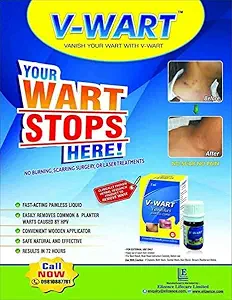 V-Wart V-Wart Remover Liquid Rapidly Eliminates Both Plantar and Common Warts | Advanced Natural Formula | Effective Painless Wart Removal Treatment with Wooden Applicator- (3 ML)
