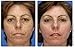 FANTASTIC SKIN BRIGHTENING WHITENING BAR COVER BLEMISHES SPOTS SCARS FRECKLES UNEVEN SKIN TONE