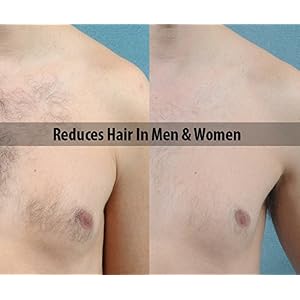 Tweepi Hair Growth Inhibitor Serum Oil- Permanent Body & Face Hair Removal- Modern Day Ant Egg Oil- Paraben Free- MADE… - Image 4