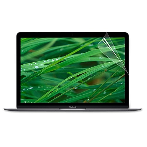 se7enline 2016 MacBook Pro 13 Fall Marmor Muster Kunststoff Hard Cover für MacBook Pro 33 cm A1706/A1708 W/OUT TOUCH Bar Touch ID (Neueste 2016) mit Tastatur, Displayschutzfolie schwarz / weiß schwarz / weiß 2016 Macbook Pro 13 inch - 9