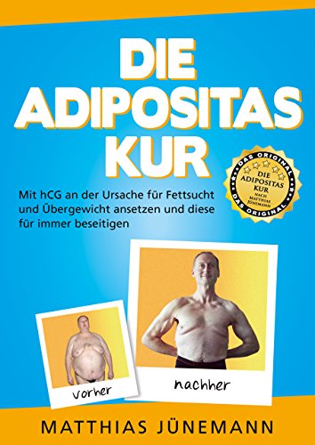 Download Die Adipositas-Kur: Mit hCG an der Ursache für Fettsucht und Übergewicht ansetzen und diese für immer beseitigen Download Die Adipositas-Kur: Mit hCG an der Ursache für Fettsucht und Übergewicht ansetzen und diese für immer beseitigen