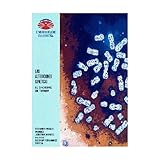 Image de Las alteraciones genéticas. El síndrome de Turner