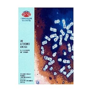 Las alteraciones genéticas. El síndrome de Turner