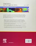 Image de Diagnóstico Por La Imagen En Retina