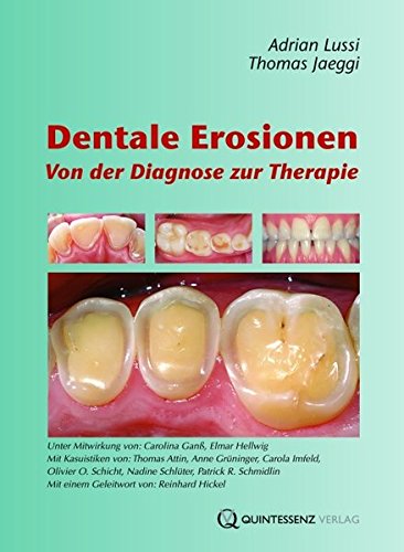 Preisvergleich Produktbild Dentale Erosionen: Von der Diagnose zur Therapie