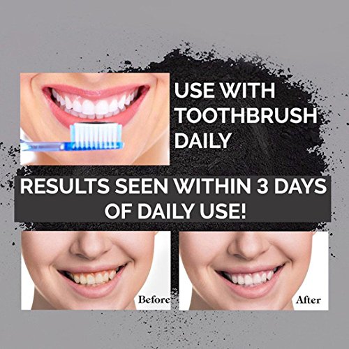 Natürliches Aktivkohle Zahnaufhellung pulver mit Aktivkohle pulver ( activated charcoal teeth whitening ) Mit Ingwerwurzel, Holeider Bentonit-Ton & Calcium NICHT-synthetisch & OHNE Chemikalien - 7