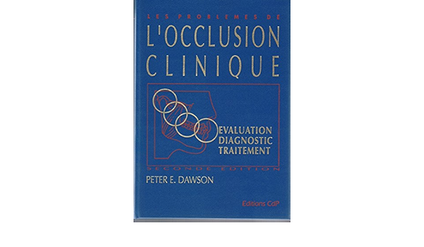 Amazon Fr Les Problemes De L Occlusion Clinique Evaluation Diagnostic Et Traitement Dawson Peter E Livres