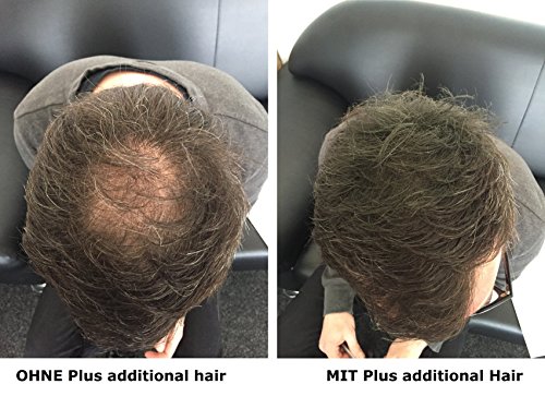 Plus additional hair Haarauffüller für Männer & Frauen – mit Soforteffekt – 25 g – gegen Teilglatze – verschiedene Farben – Haarverdichtung (schwarz) - 5