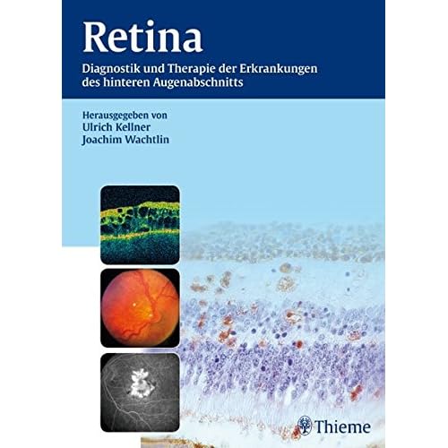 [PDF] Retina: Diagnostik und Therapie von Erkrankungen des hinteren Augenabschnitts KOSTENLOS DOWNLOAD