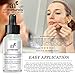 Art Naturals® Anti Acne Serum Treatment 30ml- Dermatologist Tested Product, Made with Revolutionary Evermat® & Organic Ingredients to Help Control & Get Rid of Acne - Best Pore Minimizer -For all Ages