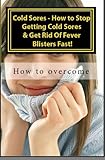 Image de Cold Sores - How to Stop Getting Cold Sores & Get Rid Of Fever Blisters Fast! Vol II (English Edition)