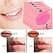 Kakaxi(TM) Collagen Crystal Lip Mask Lip Care Mask Moisture Essence (5 Pcs)